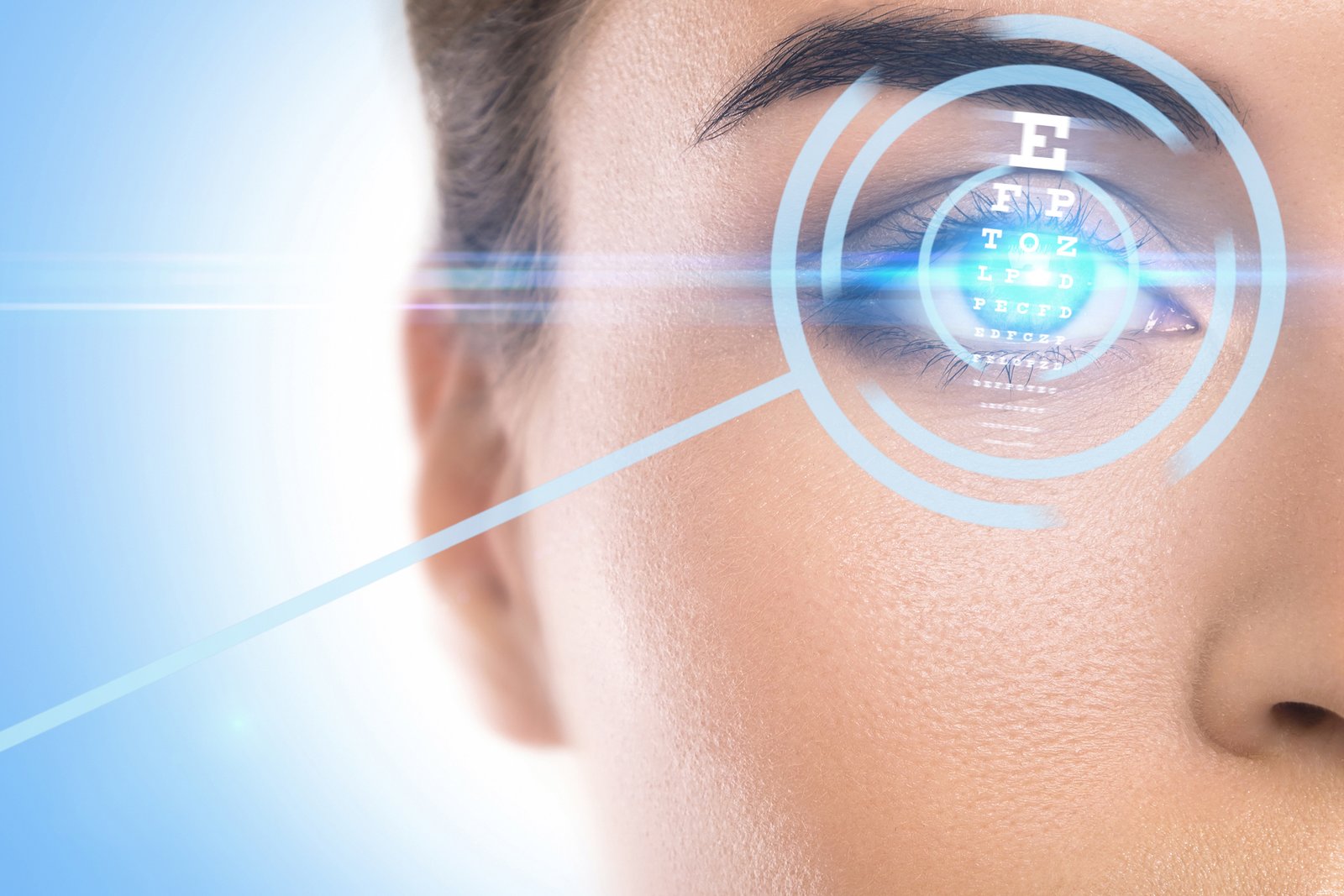 pole-ophtalmologie-colombes-la-defense Photo d'un œil avec une illustration d'un faiseau laser LASIK