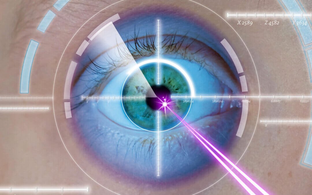 Chirurgie réfractive par LASIK : une solution efficace pour une vision nette